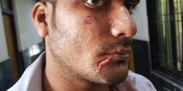 BREAKING : नशे में धुत सिपाहियों ने युवक की जमकर की पिटाई